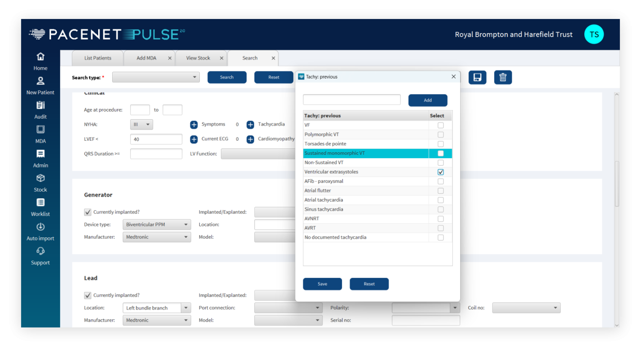 Pace Net Program Pulse - Pacenet
